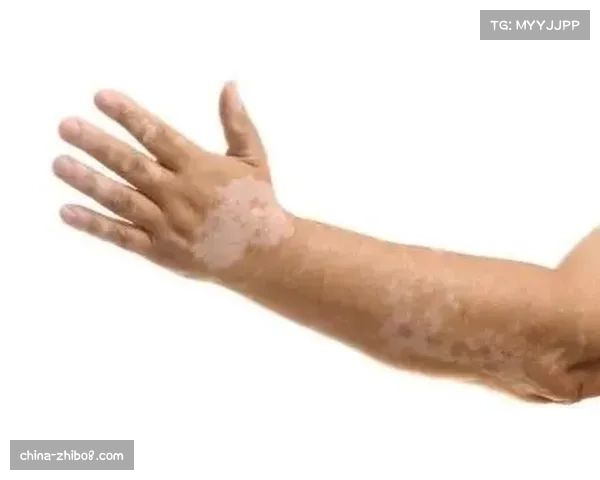 伤病专访：朱厄尔·罗伊德回顾康复历程，详解为恢复运动表现所做的数据追踪